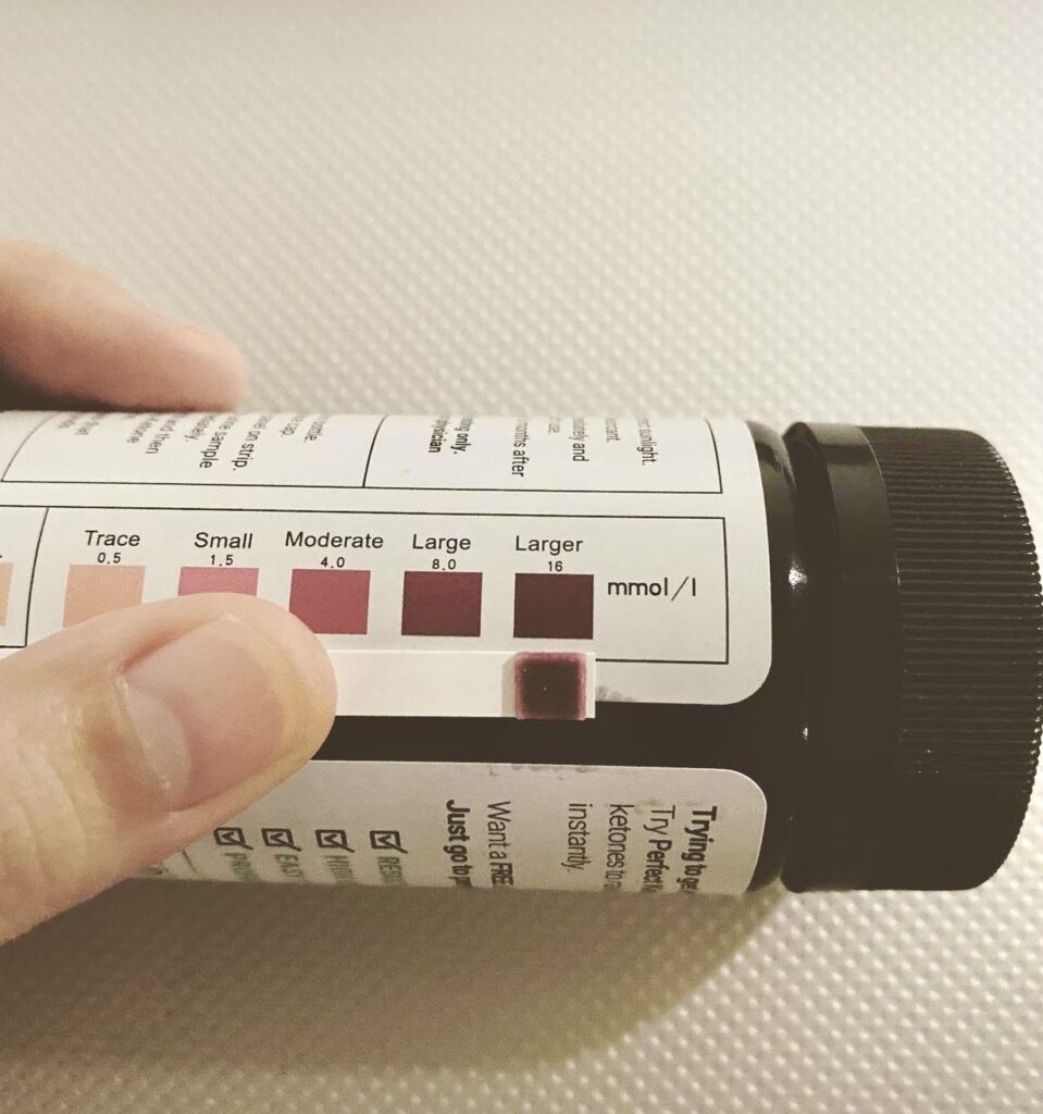 How to Use Ketone Strips for Measuring Ketones in Urine