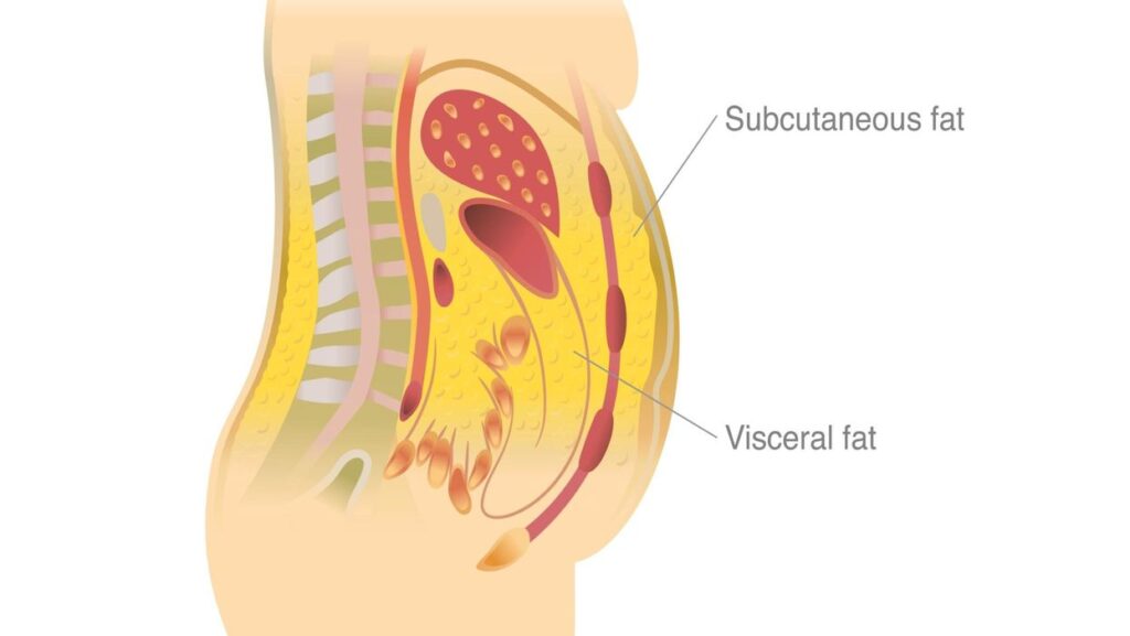 The Hazards of Abdominal Fat: Understanding the Types and Risks